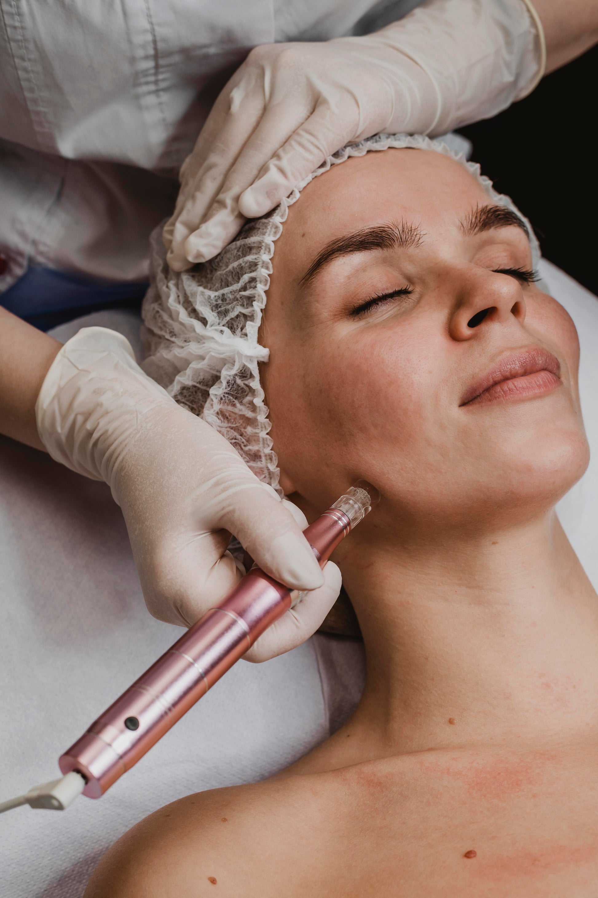 Fibroblasting Session - Precision Skin Tightening &Lift